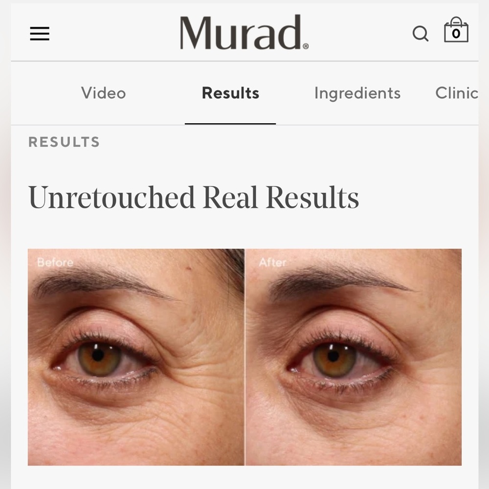 MURAD | Resurgence | Retinol Youth Renewal Eye Serum (Brand New!)💘 - Picture 2 of 15
